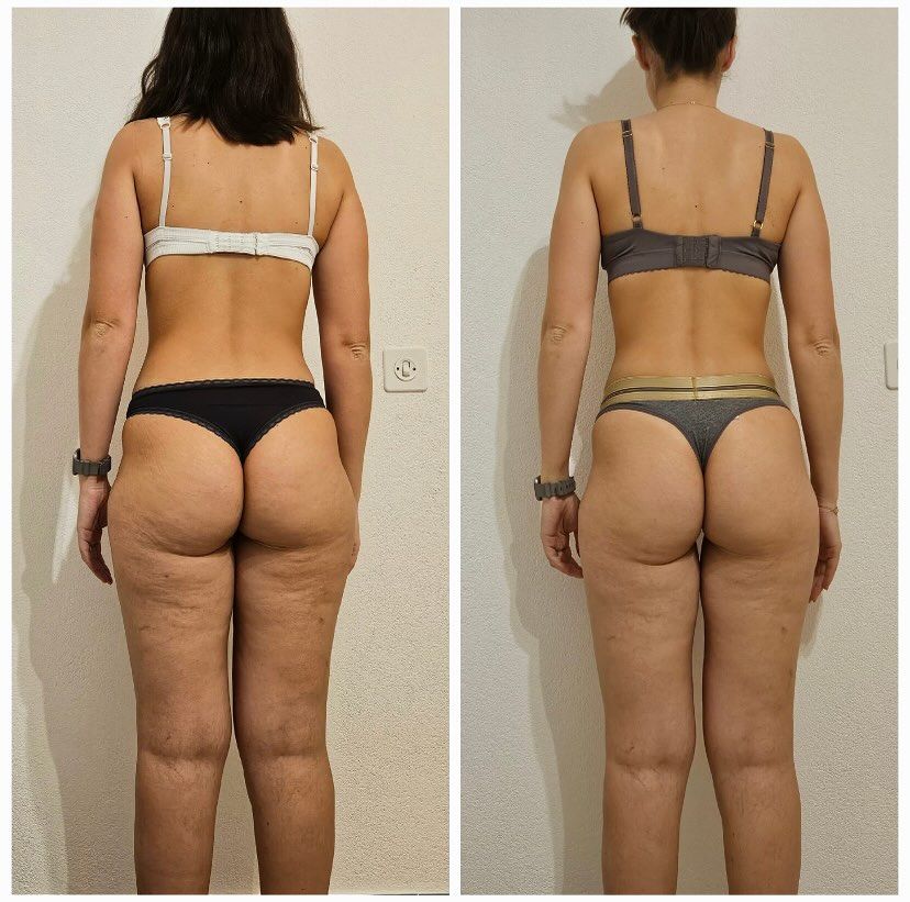 Endosphere before and after