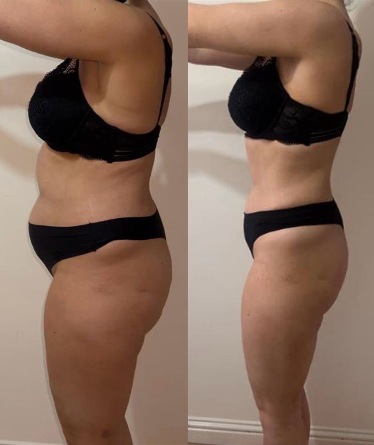 Endosphere before and after